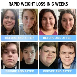 Croaie™ Meglu Oral Fluid (Fat-burning product in food grade quality, developed by the Medical Faculty of Oxford University, highly recommended by the BMA.)