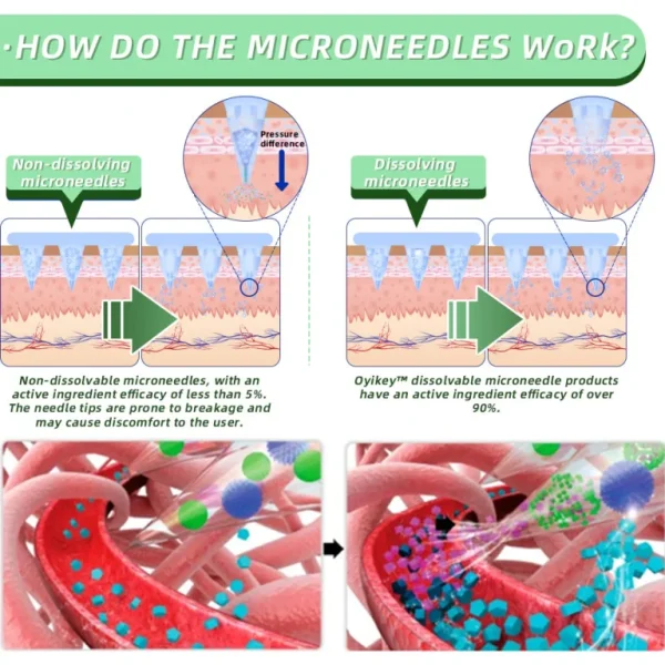 0yikey™ SMGT-GLP-1 Nano Microneedle Patches
