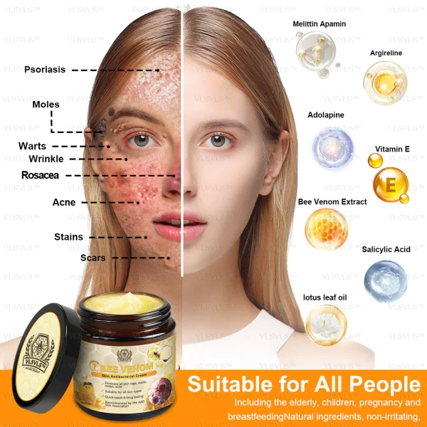 VLSVLS™ Bee Venom Skin Antibacterial Cream - Dermatologist Recommended Treats Numerous Skin Conditions (AAD Recommended)