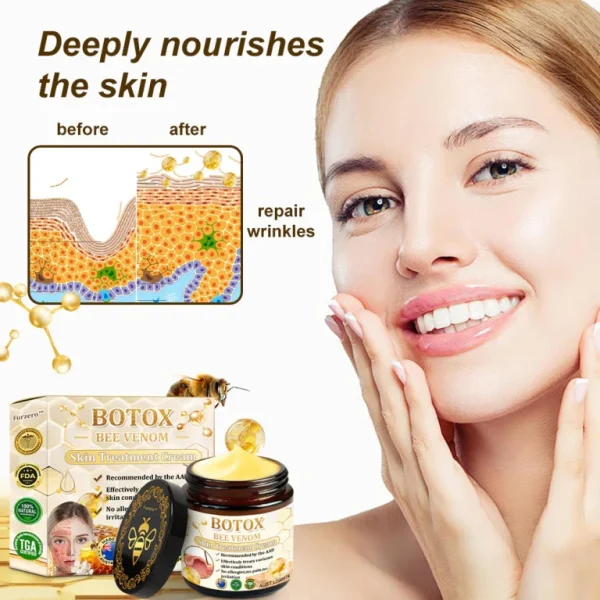 👨‍⚕️Mayo Clinic Official: Furzero™ Botox Skin Treatment Cream Anti-aging, Hydrating, Skin Repair, Even Tone, Acne and Dark Spot Treatment, Wart and Mole Removal, Psoriasis Relief