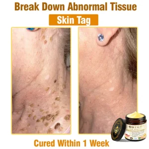 Mayo Clinic Official: Daasry™ Botox Skin Treatment Cream Anti-aging, Hydrating, Skin Repair, Even Tone, Acne and Dark Spot Treatment, Wart and Mole Removal, Psoriasis Relief