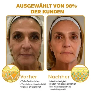 Furzero™ Botox Bienenvenom Faltenentfernungscreme