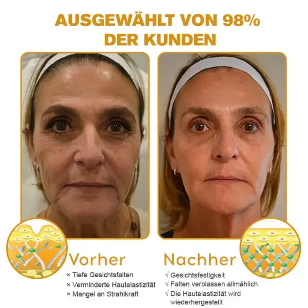 Furzero™ Botox Bienenvenom Faltenentfernungscreme