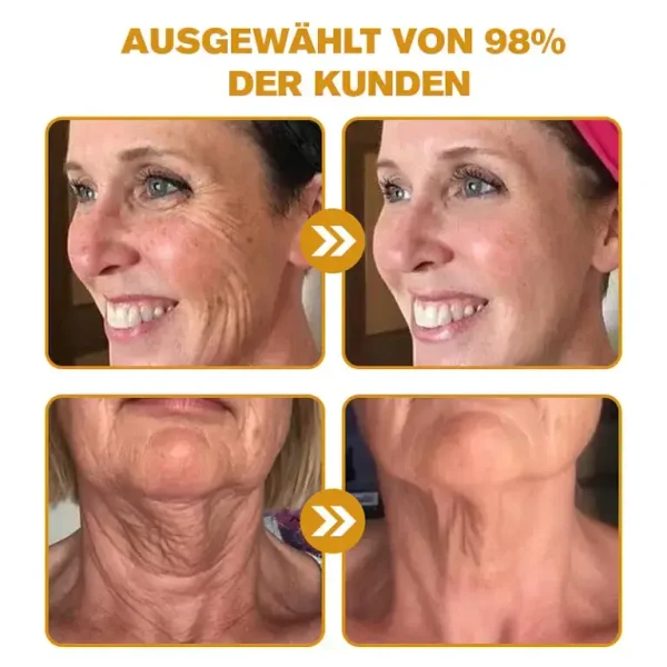 Furzero™ Botox Bienenvenom Faltenentfernungscreme