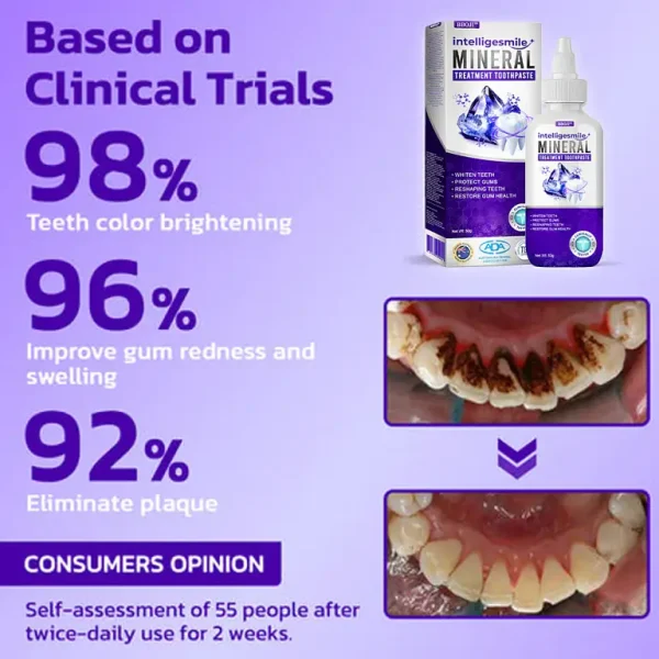 🥇BBOJI™ IntelligeSmile Mineral Treatment Toothpaste (🇦🇺 ADA Recommended)