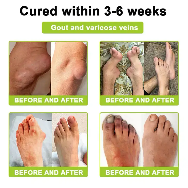 Aetheris™ Bee Venom Advanced Joint and Bone Therapy Cream 6 Aetheris™ Bee Venom Advanced Joint and Bone Therapy Cream