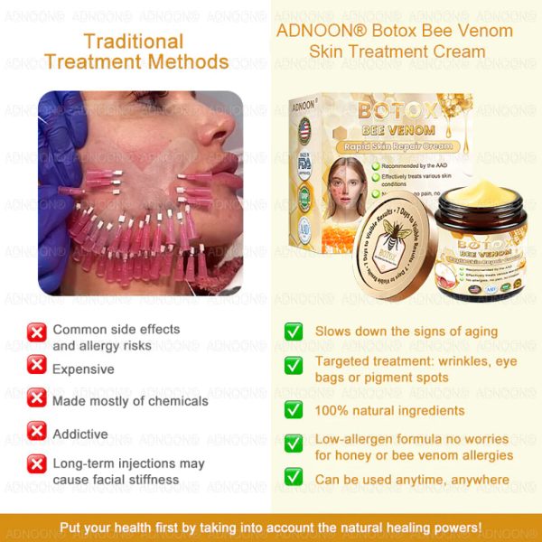 ADNOON™ Botox Skin Treatment Cream