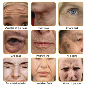 👨‍⚕️Mayo Clinic Official: Furzero™ Botox Skin Treatment Cream Anti-aging, Hydrating, Skin Repair, Even Tone, Acne and Dark Spot Treatment, Wart and Mole Removal, Psoriasis Relief