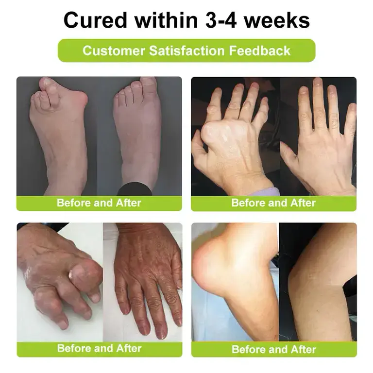 Aetheris™ Bee Venom Advanced Joint and Bone Therapy Cream 8 Aetheris™ Bee Venom Advanced Joint and Bone Therapy Cream