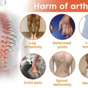 Aeehfeng™ Bee Venom Turmeric Arthritis Treatment Cream 8 Aeehfeng™ Bee Venom Turmeric Arthritis Treatment Cream