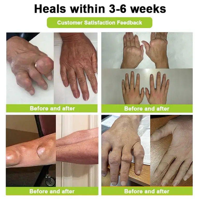 Aetheris™ Bee Venom Advanced Joint and Bone Therapy Cream 7 Aetheris™ Bee Venom Advanced Joint and Bone Therapy Cream