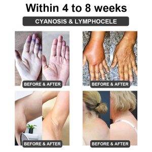 Futusly™ Ultrasonic Cavitation & Detoxification Wristband (Recommended by Plastic Surgeons)