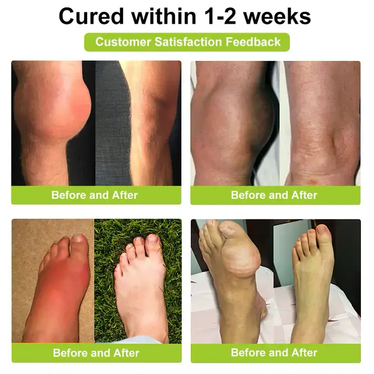 Aetheris™ Bee Venom Advanced Joint and Bone Therapy Cream 5 Aetheris™ Bee Venom Advanced Joint and Bone Therapy Cream