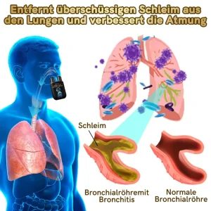 Furzero™ Natürlicher Lungen-Detox-Inhalator👨‍⚕️BfArM-certification