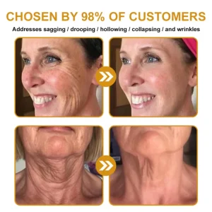 👨‍⚕️Mayo Clinic Official: Furzero™ Botox Skin Treatment Cream Anti-aging, Hydrating, Skin Repair, Even Tone, Acne and Dark Spot Treatment, Wart and Mole Removal, Psoriasis Relief