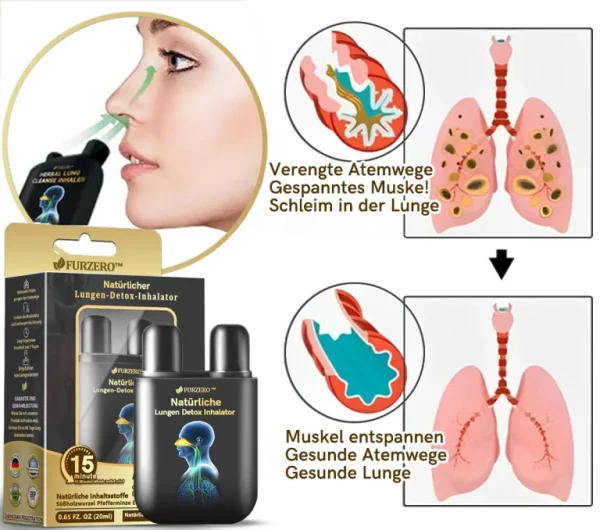 Furzero™ Natürlicher Lungen-Detox-Inhalator👨‍⚕️BfArM-certification