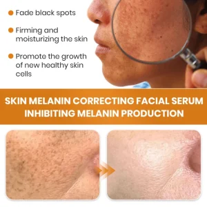 Fast Dark Spot Remover-KISSHI™ Melanin Correcting Facial Serum
