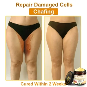 👨‍⚕️Mayo Clinic Official: Furzero™ Botox Skin Treatment Cream Anti-aging, Hydrating, Skin Repair, Even Tone, Acne and Dark Spot Treatment, Wart and Mole Removal, Psoriasis Relief
