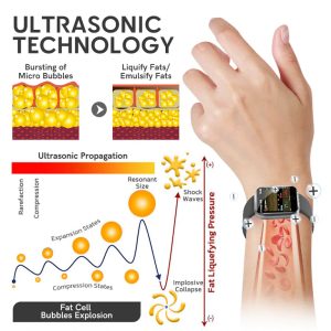 Futusly™ Ultrasonic Cavitation & Detoxification Wristband (Recommended by Plastic Surgeons)