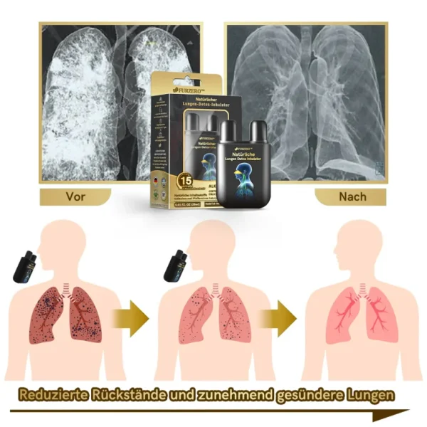 Furzero™ Natürlicher Lungen-Detox-Inhalator👨‍⚕️BfArM-certification