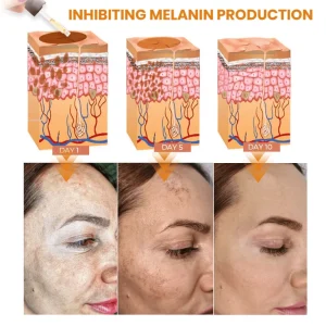 Fast Dark Spot Remover-KISSHI™ Melanin Correcting Facial Serum