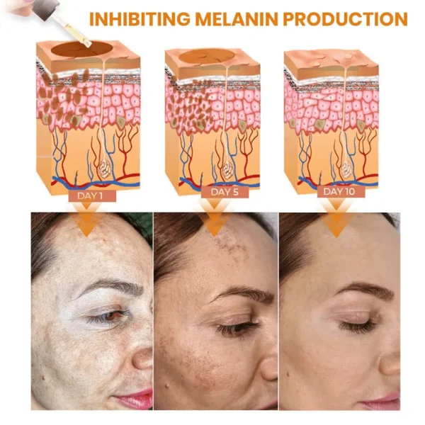 Fast Dark Spot Remover-KISSHI™ Melanin Correcting Facial Serum