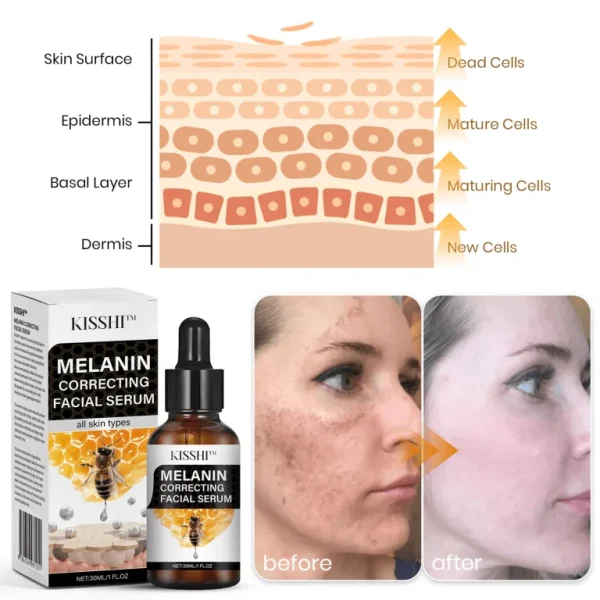 Fast Dark Spot Remover-KISSHI™ Melanin Correcting Facial Serum