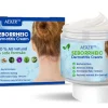 AEXZR™ Seborrheic Dermatitis Cream