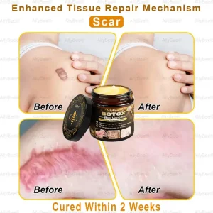 AllyBee® Botox Skin Treatment Cream