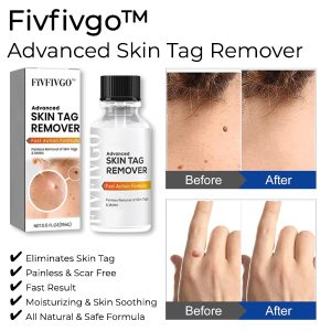 Fivfivgo™ Advanced Skin Tag Remover - Fast Action Formula 11 Fivfivgo™ Advanced Skin Tag Remover - Fast Action Formula