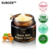 KUBOZN™ 7-Day Relief Cream 🌿 Your Go To Solution for Itchiness & Dark Spots in Intimate Areas
