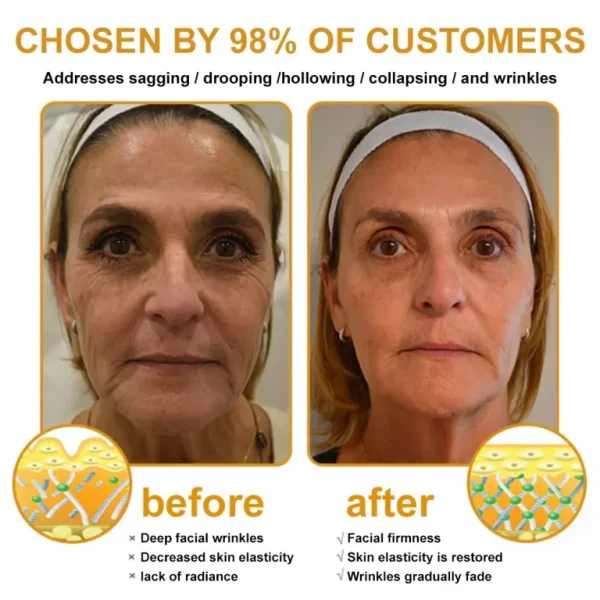 👨‍⚕️Mayo Clinic Official: Furzero™ Botox Skin Treatment Cream Anti-aging, Hydrating, Skin Repair, Even Tone, Acne and Dark Spot Treatment, Wart and Mole Removal, Psoriasis Relief