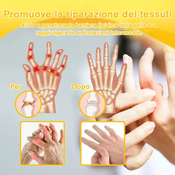 Lotmay™ Joint Therapy Spray (Magnesium Oil & Bee Venom) 8 Lotmay™ Joint Therapy Spray (Magnesium Oil & Bee Venom)