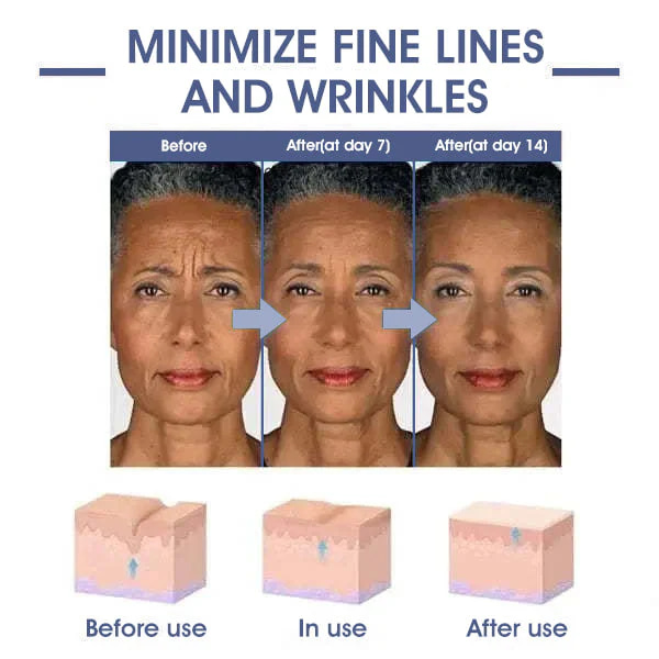 LOVILDS® Advanced Firming & Wrinkle-Reducing Cream: Restore Skin Elasticity 5 LOVILDS® Advanced Firming & Wrinkle-Reducing Cream: Restore Skin Elasticity