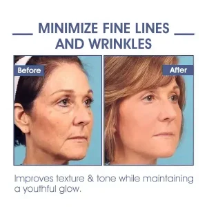 LOVILDS® Advanced Firming & Wrinkle-Reducing Cream: Restore Skin Elasticity 17 LOVILDS® Advanced Firming & Wrinkle-Reducing Cream: Restore Skin Elasticity