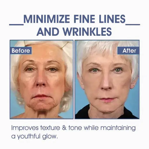 LOVILDS® Advanced Firming & Wrinkle-Reducing Cream: Restore Skin Elasticity 3 LOVILDS® Advanced Firming & Wrinkle-Reducing Cream: Restore Skin Elasticity