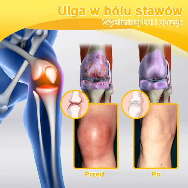 TLOPA® Botulinum Toxin and Bee Venom Pain Relief Balm and Bone Healing 9 TLOPA® Botulinum Toxin and Bee Venom Pain Relief Balm and Bone Healing
