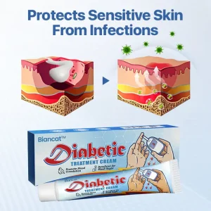 Best Deal Biancat® VitaGluco Diabetes Treatment Cream 9 Biancat® VitaGluco Diabetes Treatment Cream