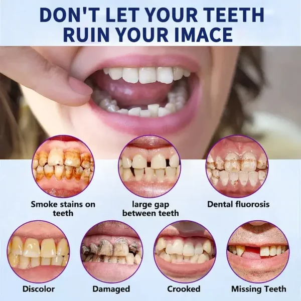 SmileFitPro New Generation Flexible Full Denture Solution
