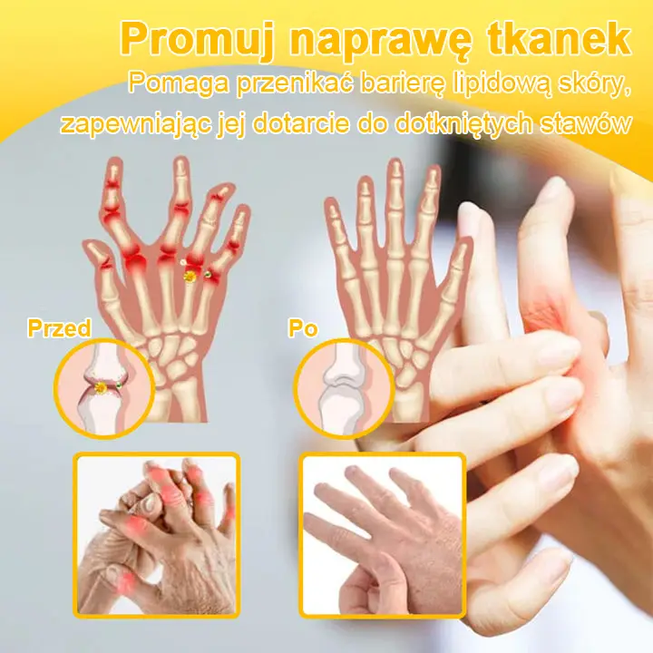 TLOPA® Botulinum Toxin and Bee Venom Pain Relief Balm and Bone Healing 7 TLOPA® Botulinum Toxin and Bee Venom Pain Relief Balm and Bone Healing
