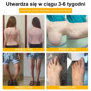 TLOPA® Botulinum Toxin and Bee Venom Pain Relief Balm and Bone Healing 22 TLOPA® Botulinum Toxin and Bee Venom Pain Relief Balm and Bone Healing