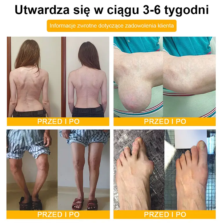 TLOPA® Botulinum Toxin and Bee Venom Pain Relief Balm and Bone Healing 6 TLOPA® Botulinum Toxin and Bee Venom Pain Relief Balm and Bone Healing
