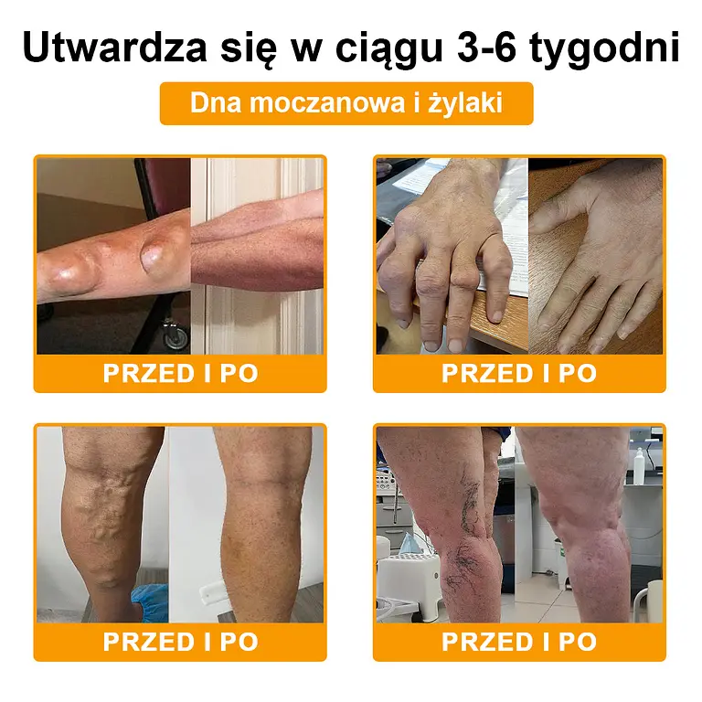 TLOPA® Botulinum Toxin and Bee Venom Pain Relief Balm and Bone Healing 4 TLOPA® Botulinum Toxin and Bee Venom Pain Relief Balm and Bone Healing