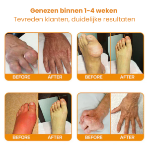 Ourlyard™ Bee Venom Joint Healing Cream 7 Ourlyard™ Bee Venom Joint Healing Cream