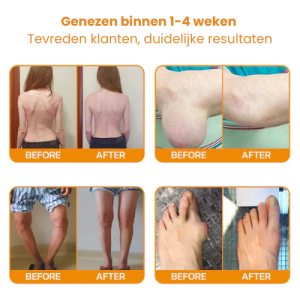 Ourlyard™ Bee Venom Joint Healing Cream 6 Ourlyard™ Bee Venom Joint Healing Cream