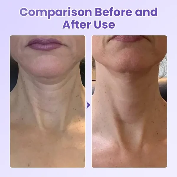 Biancat® NeckYouth Peptide Anti-Wrinkle Patch