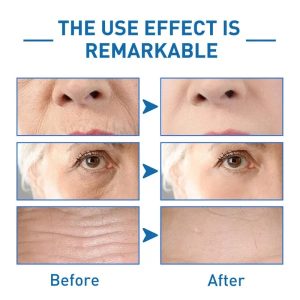 Hyalu B5 Serum, Hyaluronic Acid Serum for Face with Vitamin B5, Anti-Aging Serums, Hydrating B5 Serum