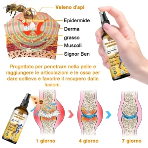 Lotmay™ Joint Therapy Spray (Magnesium Oil & Bee Venom) 16 Lotmay™ Joint Therapy Spray (Magnesium Oil & Bee Venom)