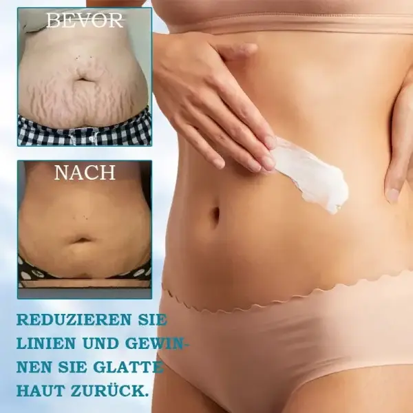 LOVILDS® Advanced Firming & Wrinkle-Reducing Cream: Restore Skin Elasticity 6 LOVILDS® Advanced Firming & Wrinkle-Reducing Cream: Restore Skin Elasticity