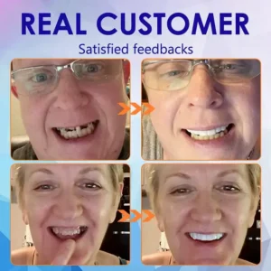 SmileFitPro New Generation Flexible Full Denture Solution